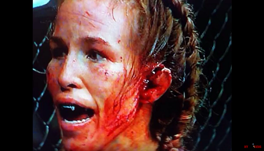 Eye Takes an Ear - Jessica Eye Literally Punches Leslie Smith's Ear Off at UFC 180