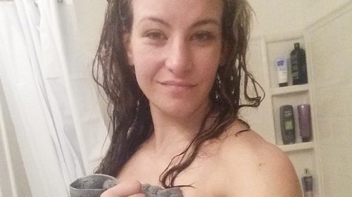 Miesha Tate post fight broken orbital bone photo