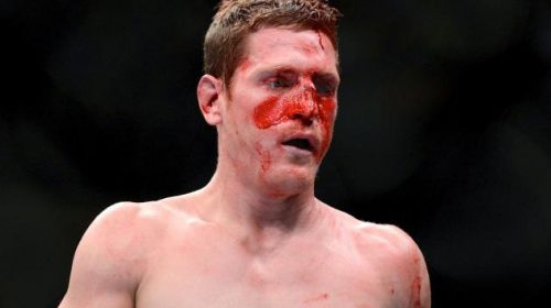 Lawsuits piling up on ZUFFA from additional former UFC fighters