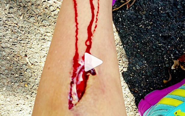 Bec Rawlings sustains nasty leg injury, calls it 'shin vagina'