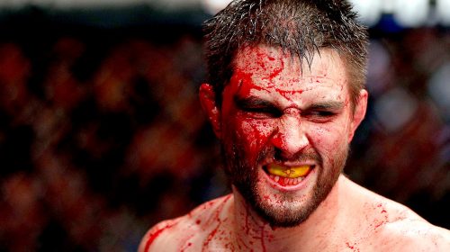 Carlos Condit - UFC Fight Night Goiania: Post fight bonus recap