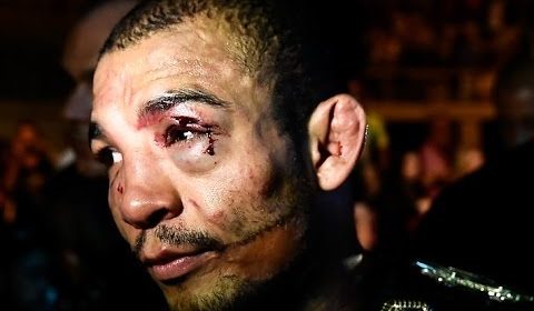 A movie about Aldo's life is in production