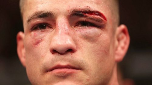 Diego Sanchez debuts at featherweight in Mexico