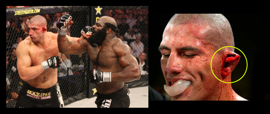 Kimbo Slice vs James Thompson