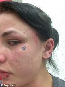 Photos of injuries that Jessy Jess says were inflicted by Julian Wallace