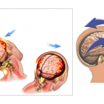 From The Coach's Corner: This Is Your Brain On MMA