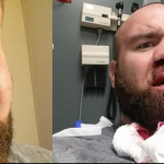 Bumps, bruises, and broken noses - Victory FC heavyweight champ Daniel Gallemore