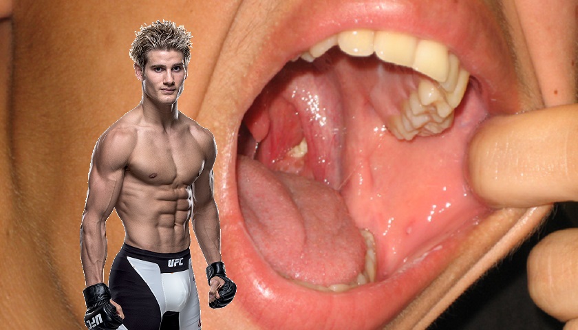 Sage Northcutt tonsils