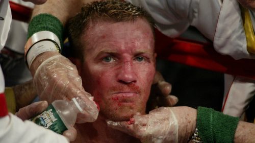 Micky Ward