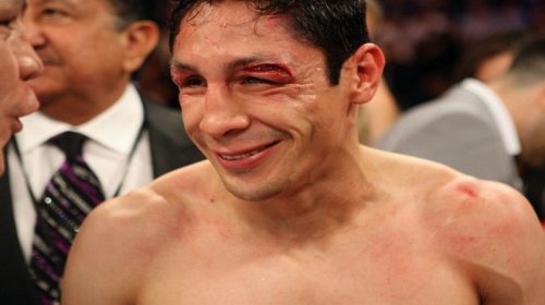 Boxer, Israel Vázquez, to lose right eye after surgery in coming months