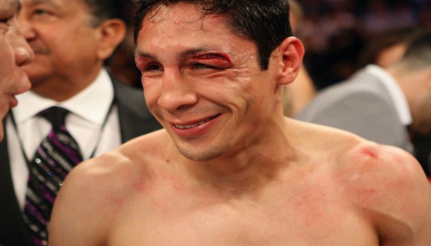 Boxer, Israel Vázquez, to lose right eye after surgery in coming months