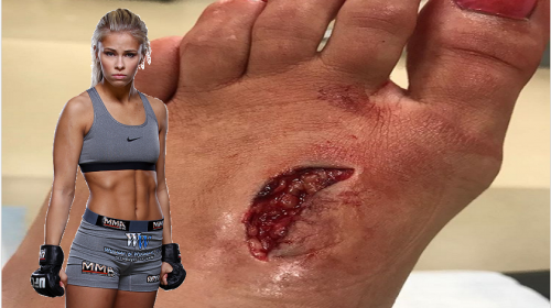 Paige VanZant training again one day after nasty foot injury