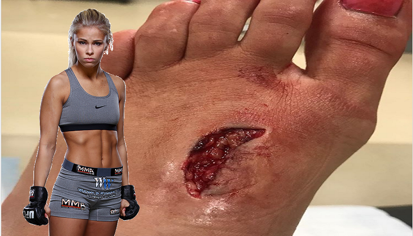Paige VanZant training again one day after nasty foot injury.