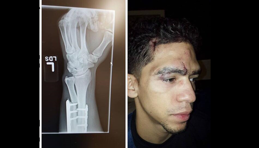 Injury Update: Matt Lozano - Broken arm, 20 stitches, after Bellator 186 loss