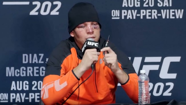 Nate Diaz Speaking about the benefits of Vaping CBD in a UFC conference.