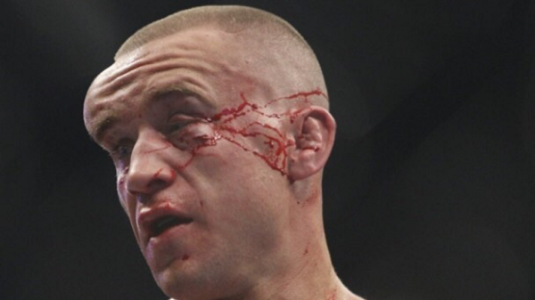 Study: Rate and risk of head injury in mixed martial arts remain unknown