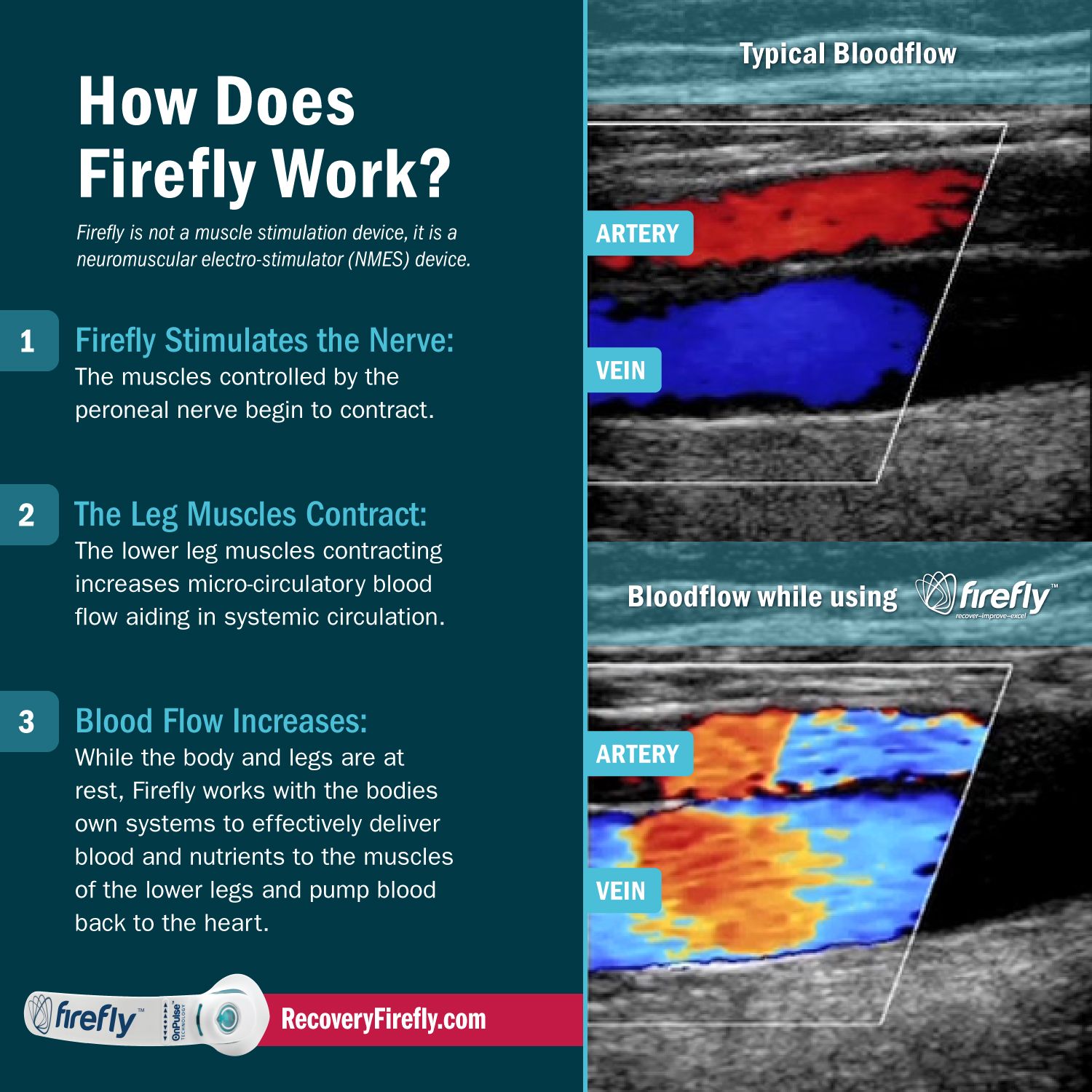 firefly, athlete recovery, blood flow