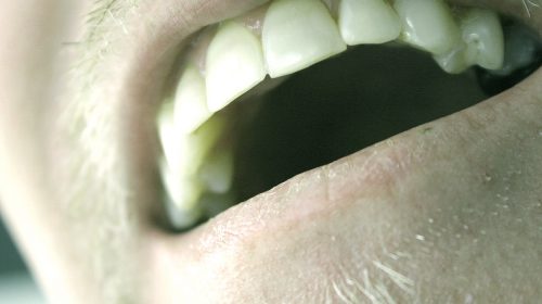 Your Teeth, And Their Crucial Impact On Performance