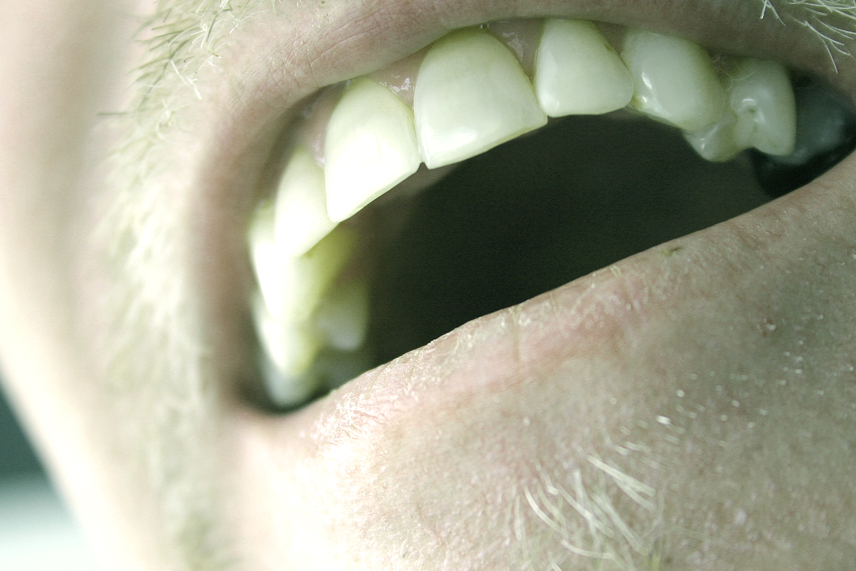 Your Teeth, And Their Crucial Impact On Performance