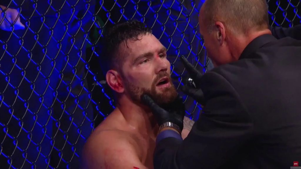 Chris Weidman's coach: "Loss to Jacare was a big setback"