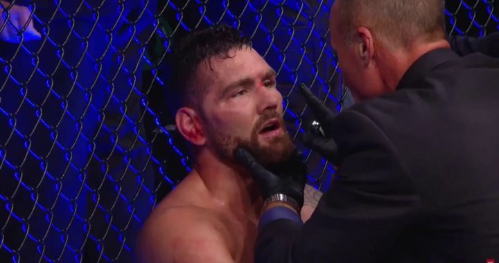 Chris Weidman's coach: "Loss to Jacare was a big setback"