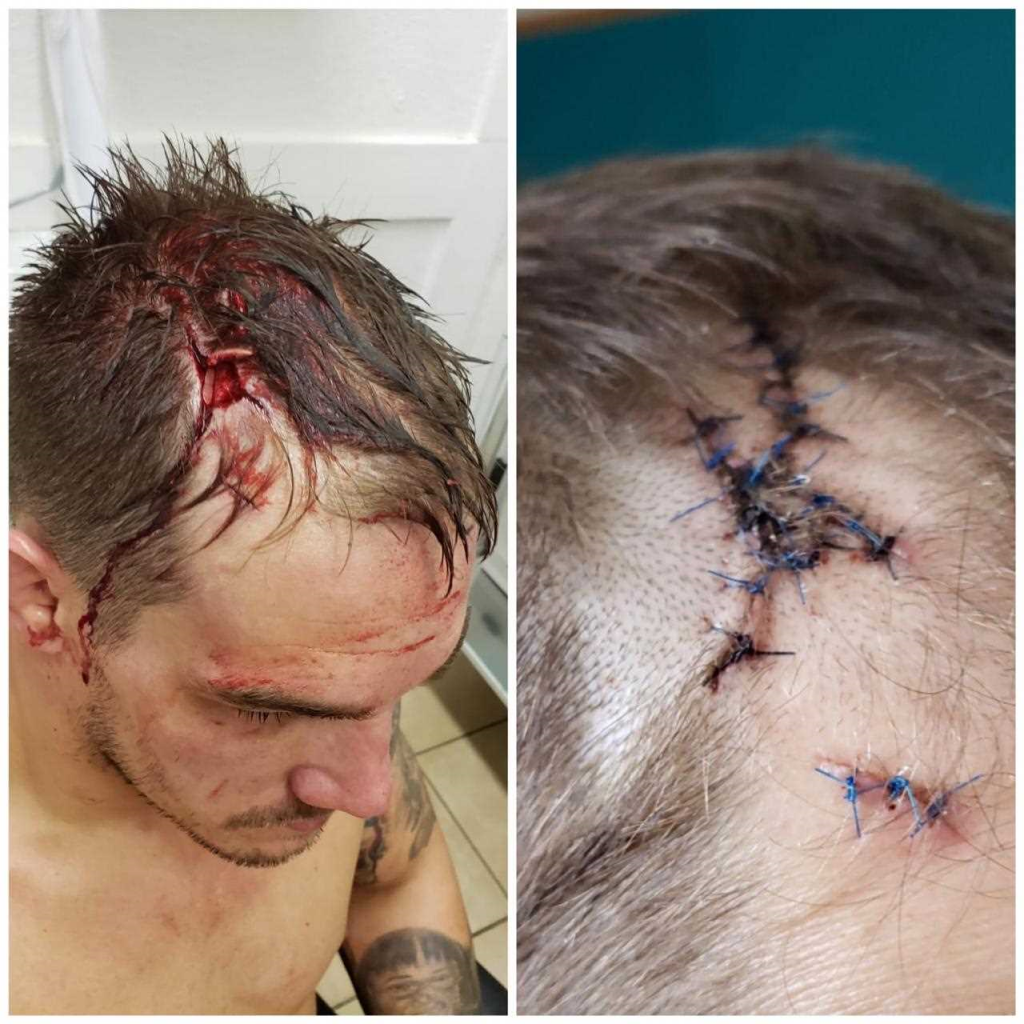 Adam Townsend reveals the horrifying cut from Brave 19