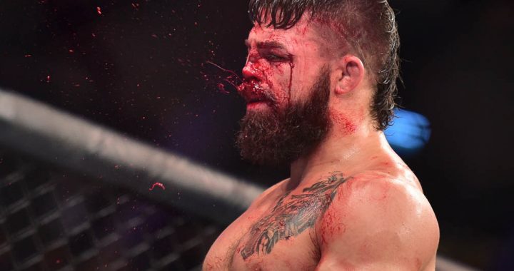 mma injuries, Mike Perry