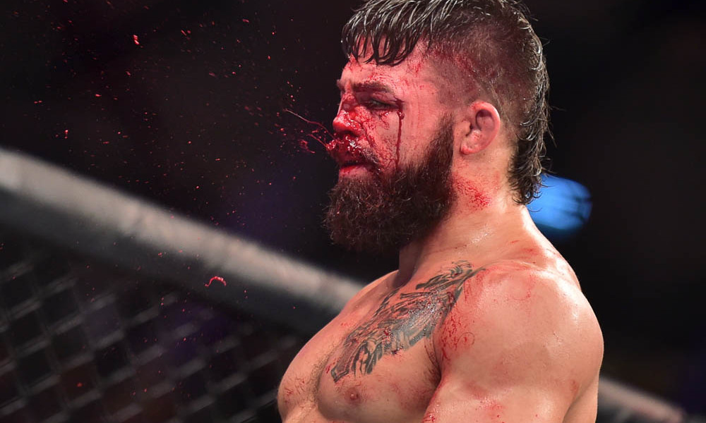 mma injuries, Mike Perry