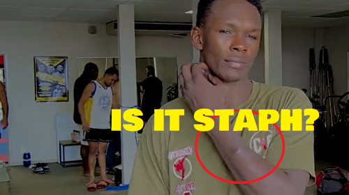 Adesaya denies having staph infection ahead of UFC 248