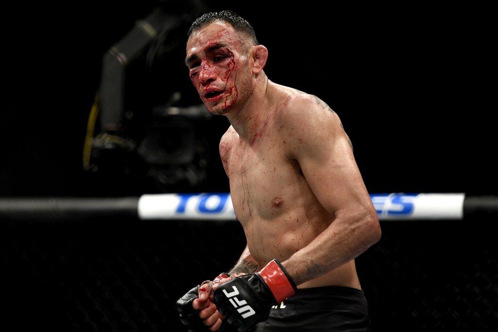 Tony Ferguson suffers orbital fracture in loss to Justin Gaethje