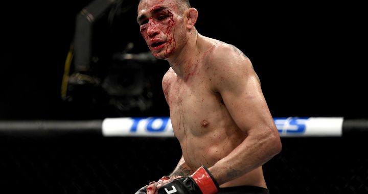 Tony Ferguson suffers orbital fracture in loss to Justin Gaethje