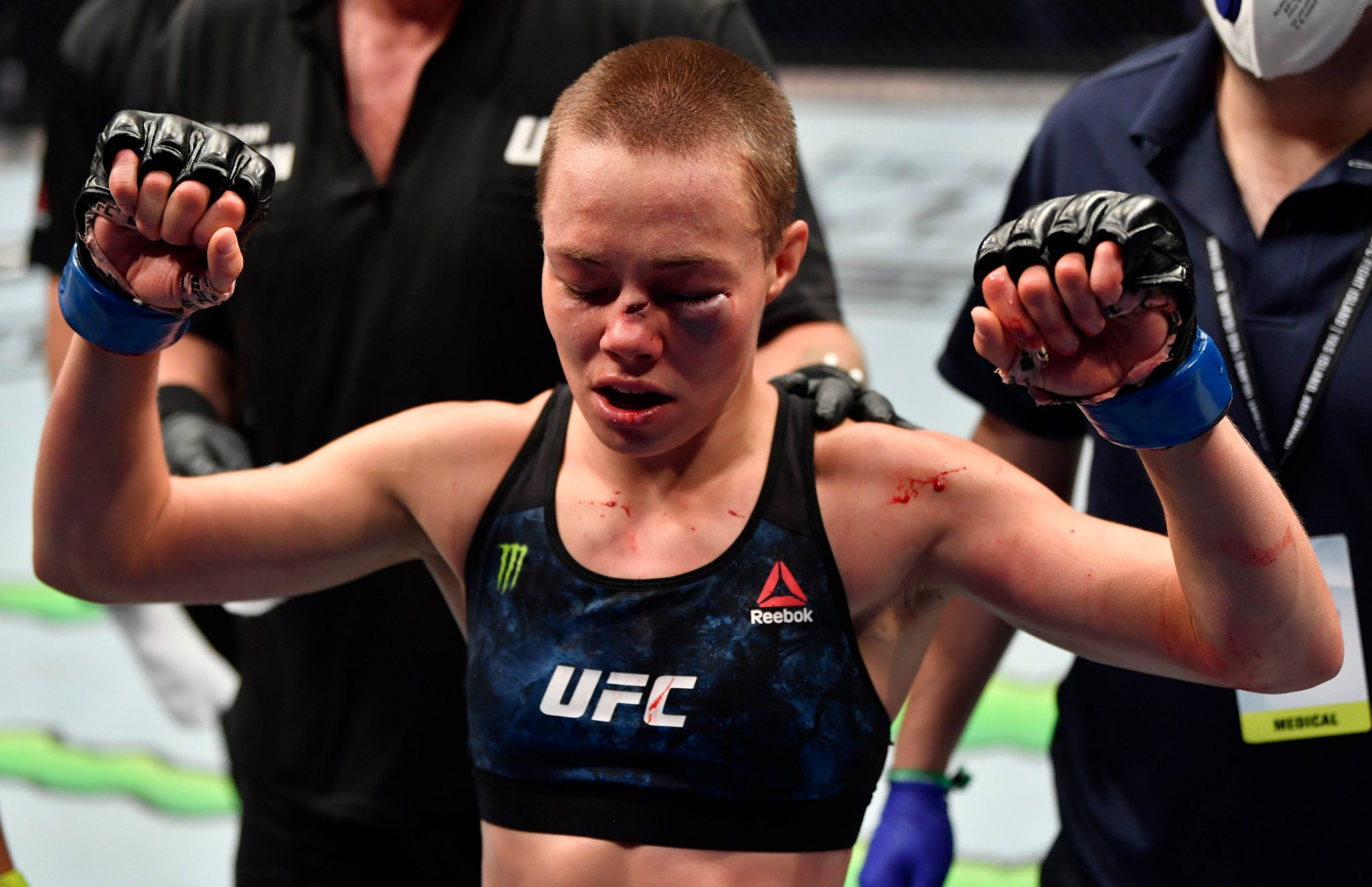 Rose Namajunas Undergoes Successful Nose Surgery Eyes Fight With Zhang Weili