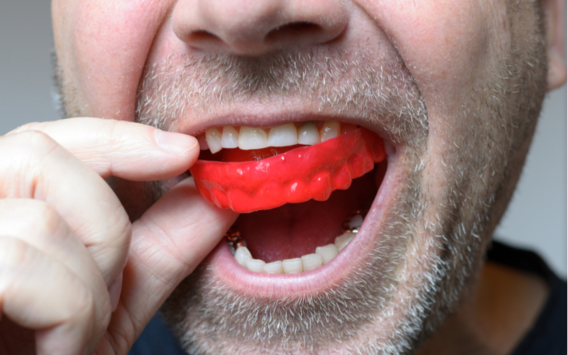 dental tips, mouthguard