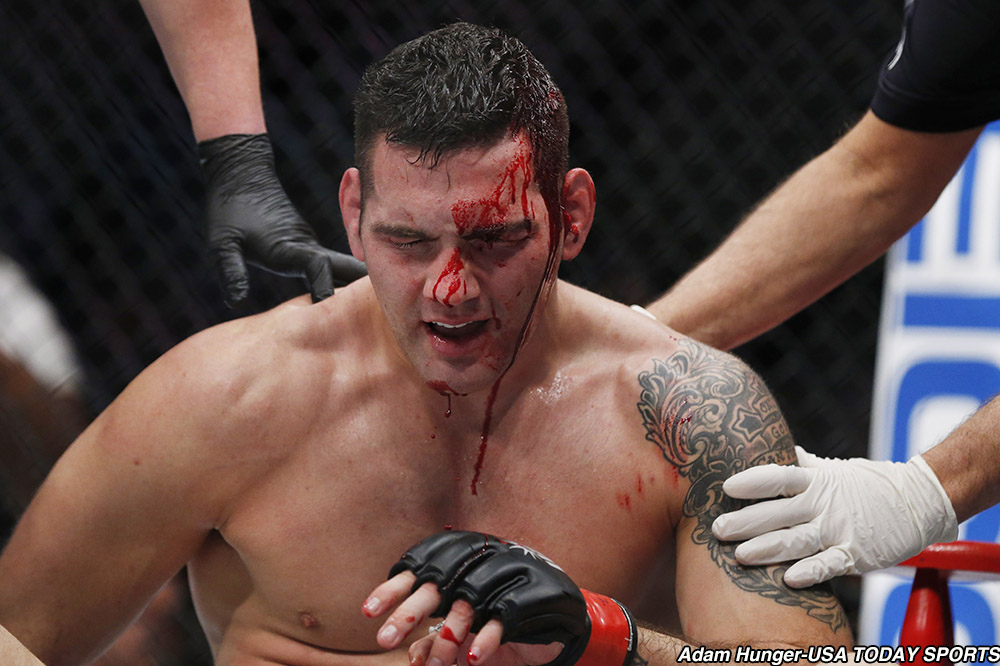 Where Chris Weidman Did The Best Ever Mma Sports Jioforme