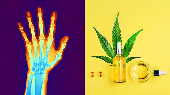 cbd, arthritis