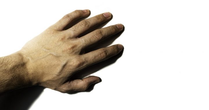 Why You Should Visit A Vein Doctor Immediately If You See These Signs