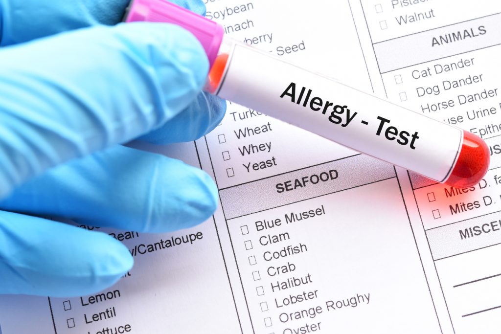 food allergy testing