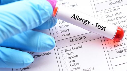 food allergy testing