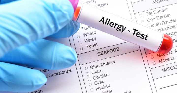 food allergy testing