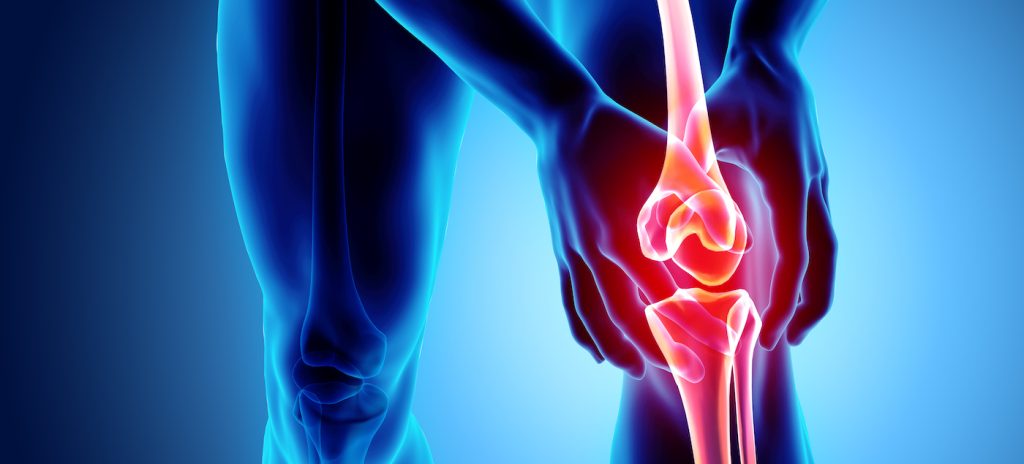 Joint Pain and Arthritis