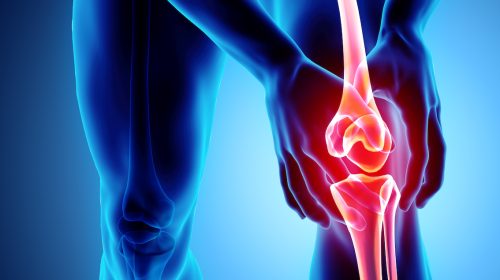 Joint Pain and Arthritis