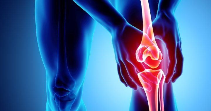 Joint Pain and Arthritis