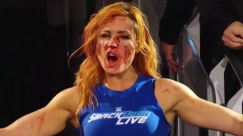 becky lynch