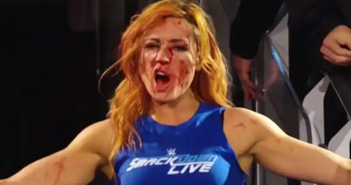 becky lynch