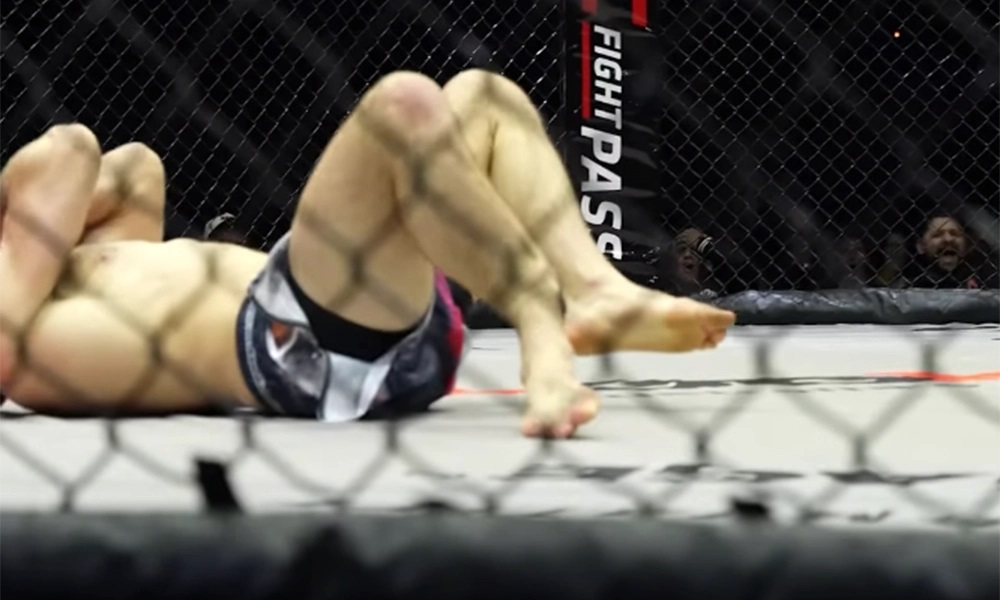 Australian MMA Prospect Jack Becker suffers horrific injury at Eternal MMA 66