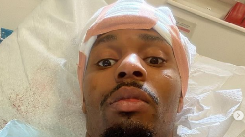 Lerone Murphy hit by car while cycling, "nearly bleeds out"