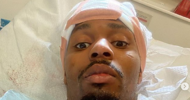 Lerone Murphy hit by car while cycling, "nearly bleeds out"