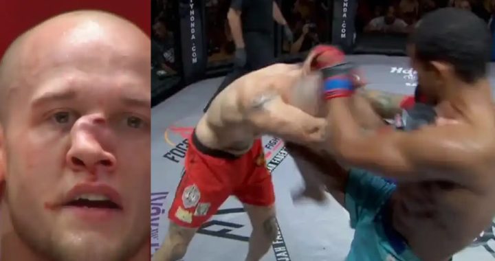 broken nose, Blake Perry