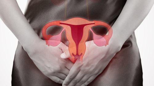 Tilted Uterus