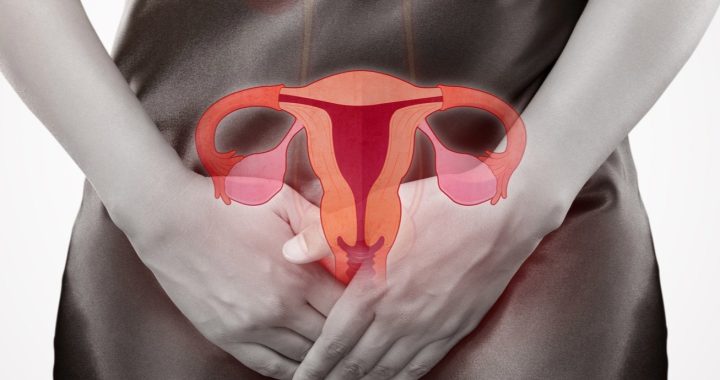 Tilted Uterus